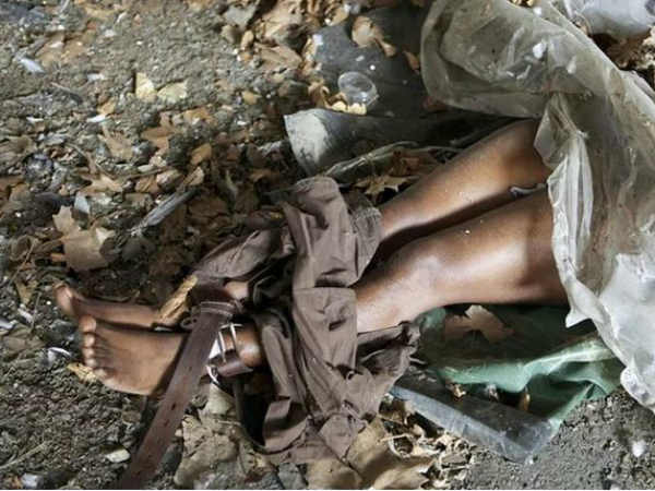 தீவிர சிகிச்சை : 