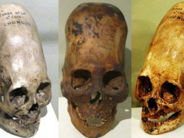 பல இடங்கள் : 