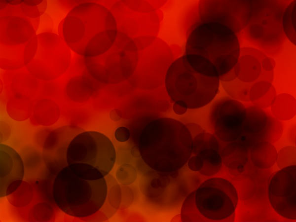  அமிலம் : 