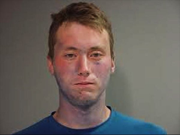 மெதிமோக்ளோபினெமியா