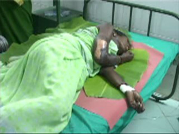 பைத்தியம் : 