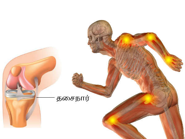 List Of 11 Foods That Cause Inflammation Of The Joints List Of 11 Foods That Cause Inflammation Of The Joints