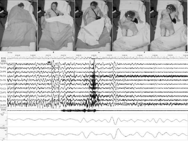 கண்டறியும் முறை : 