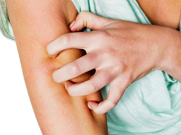 அறிகுறிகள்