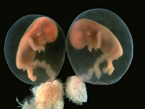 ரெட்டை குழந்தை உருவாகும்விதம்