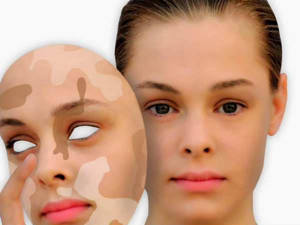 ஆபத்து காரணிகள்: