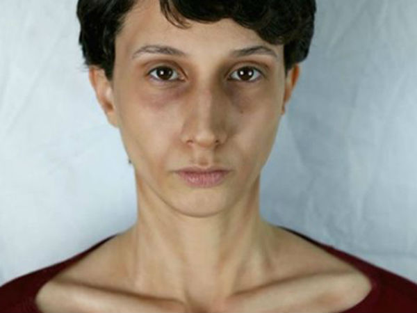 மனக் கோளாறு!