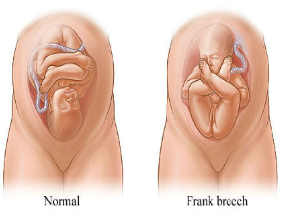 இயற்கை வழிகள்