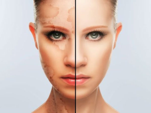 காரணங்கள்: