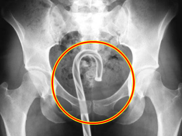 அமெரிக்க ஆணையம்!