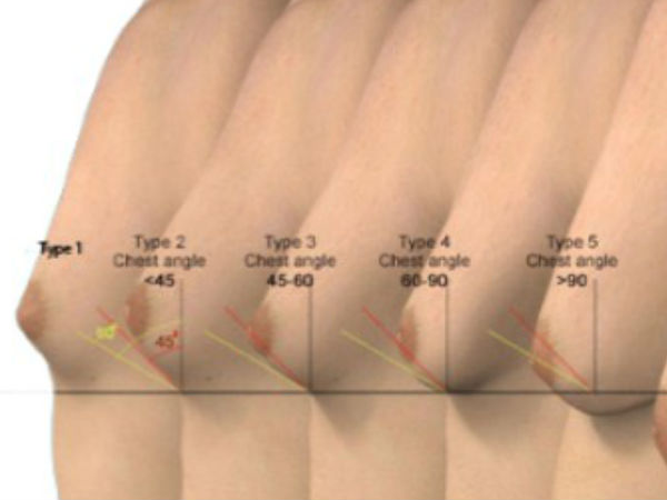 காரணங்கள்