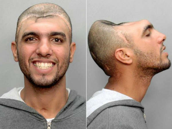 பாதி தலை : 