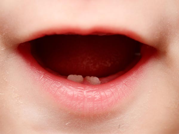 பல் முளைத்தல் 