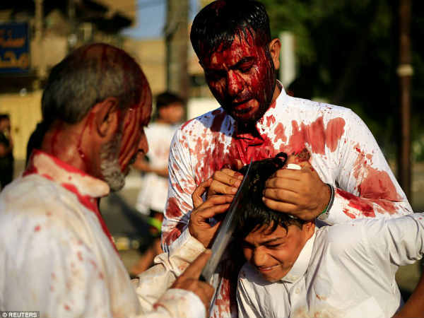 ரத்தக்காயம் : 