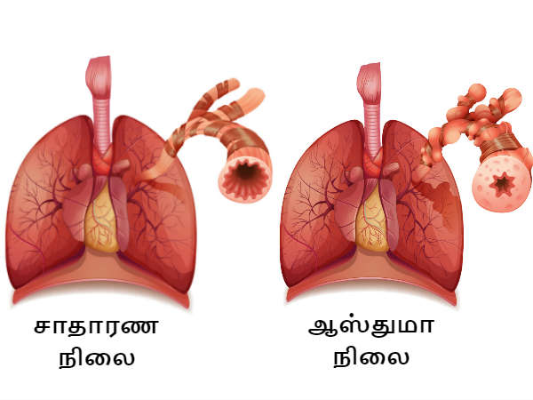 நிவாரணம்