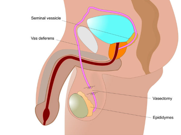 செய்யும் முறை