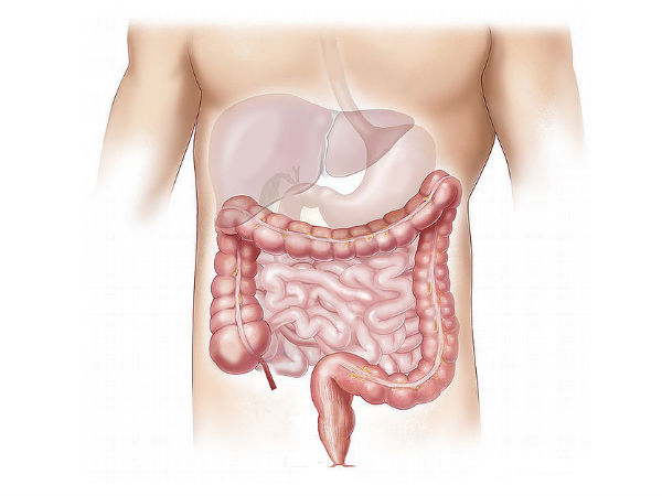 டாக்சின்கள்