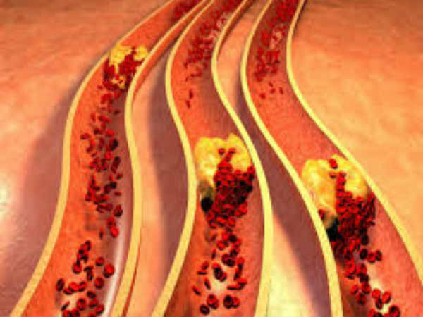 கெட்ட கொழுப்பு : 