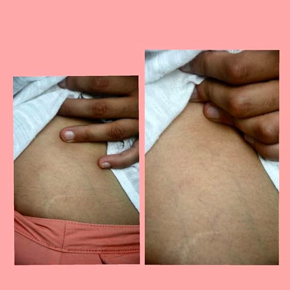 அசிங்கம்?