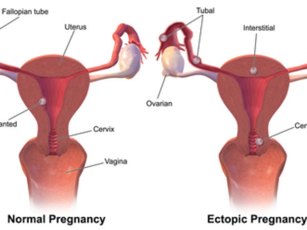 காரணங்கள் : 