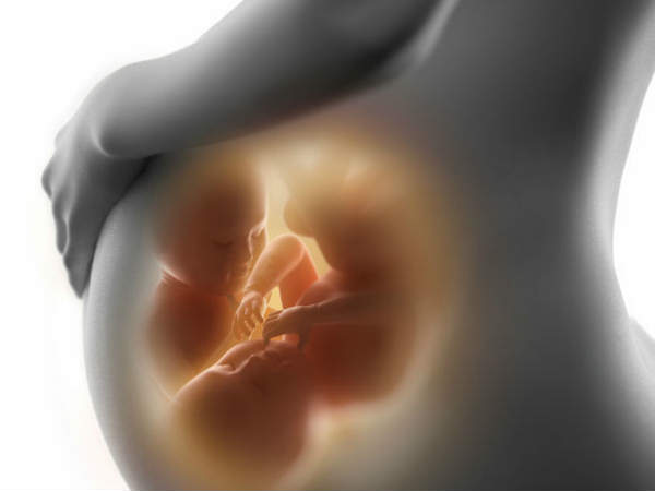 காரணம் : 