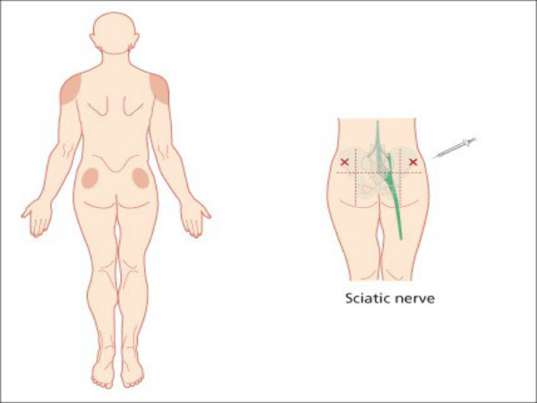 தசையின் பயன்கள்