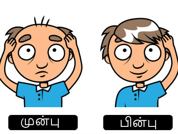 உச்சந்தலை