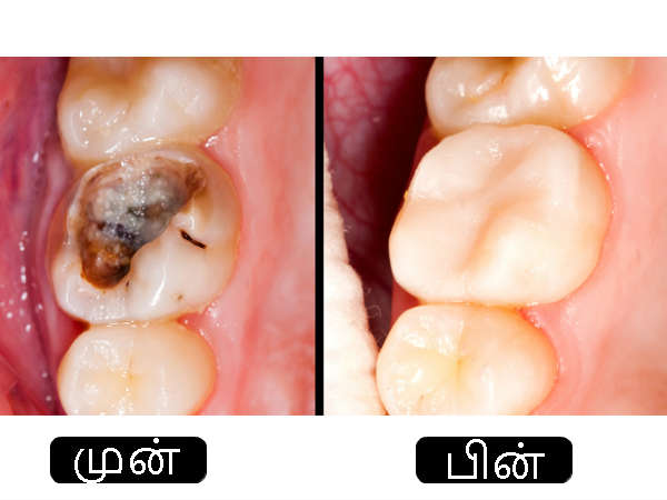 அறுவை சிகிச்சையின் போது