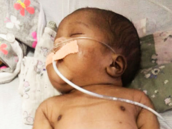 உயிருக்கு போராடும் தினக்கூலியின் குழந்தை காப்பாற்ற உதவி 