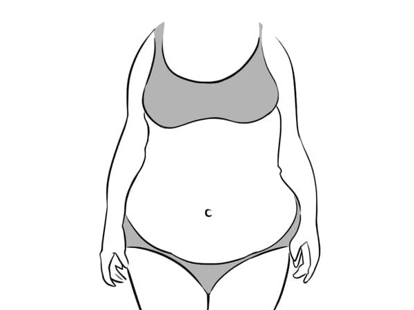 டைப் #3 டைப் #3