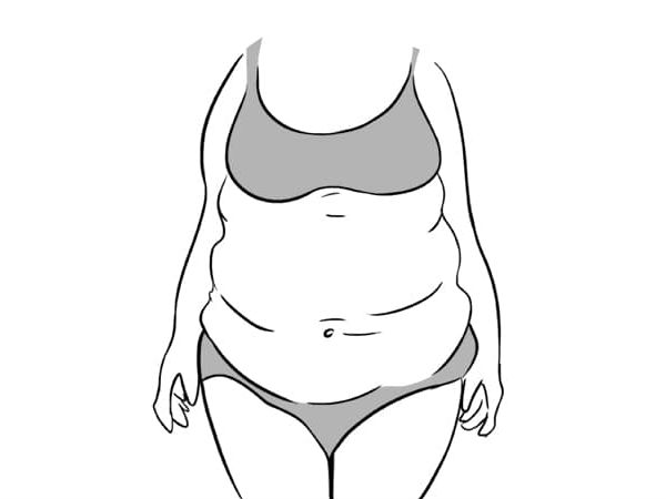 டைப் #4 டைப் #4