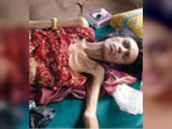 எய்ட்ஸ்!