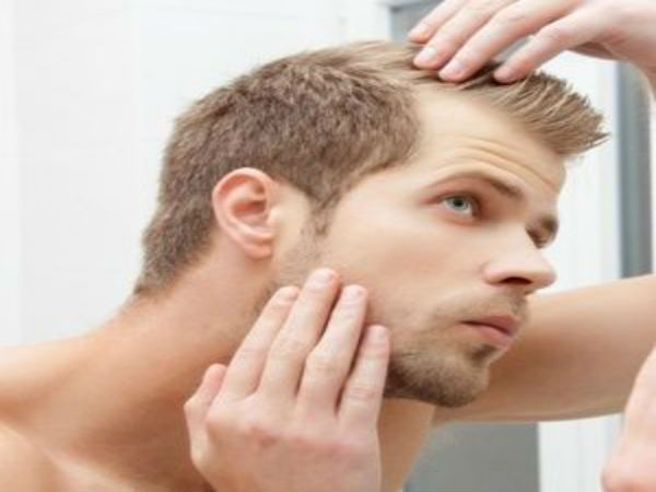 வழுக்கைக்கு முதல் காரணம் முடிஉதிர்தல்