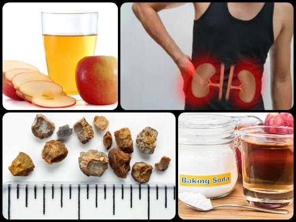 # பித்தநீர்க்கட்டி