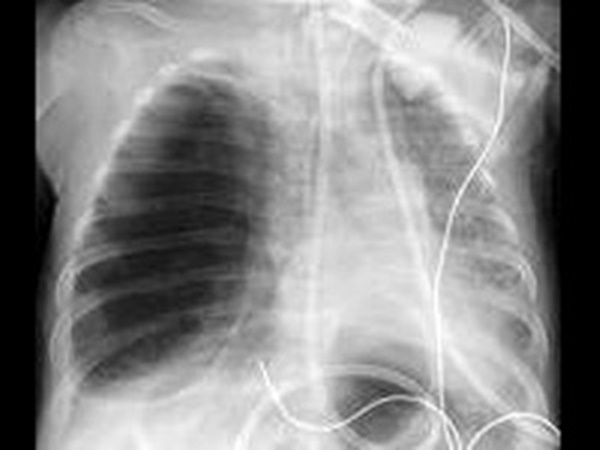 கண்டறியும் முறைகள் 