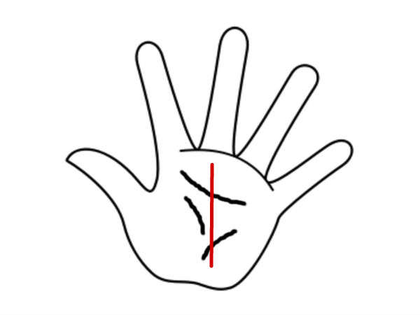 அறிகுறி #1