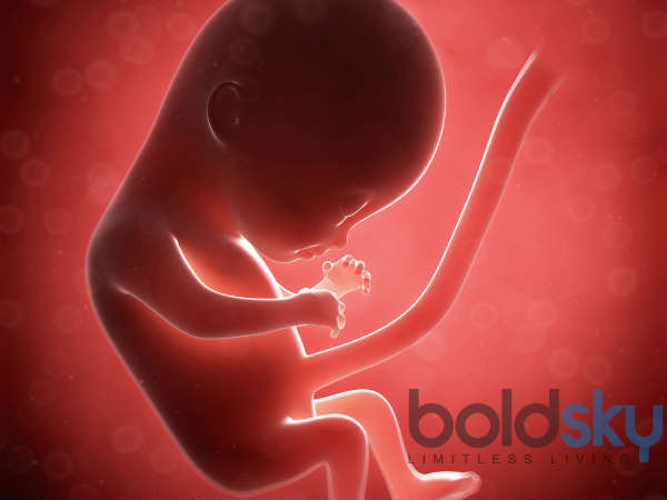 இறந்து போன குழந்தை - Stillbirth 