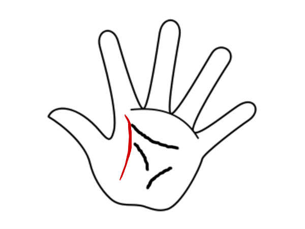 அறிகுறி #2