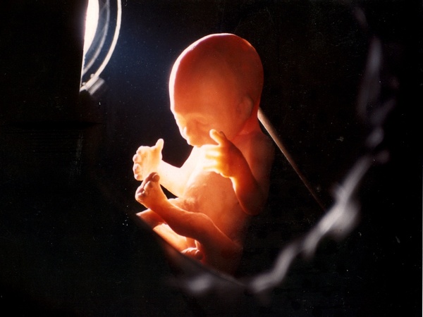 சீக்கிரம் கல்யாணம்!