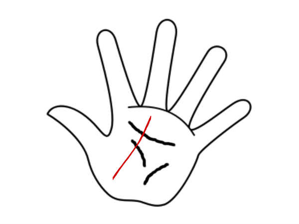 அறிகுறி #4