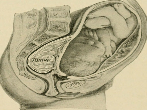 வலியின் தீவிரம்!