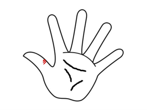 அறிகுறி #5