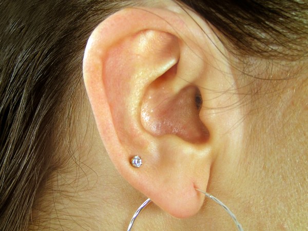 காது குத்திய பின்..!