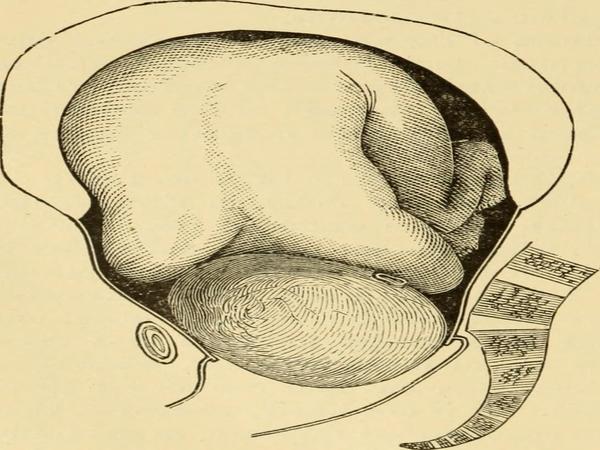 மருத்துவ முறைகள்!