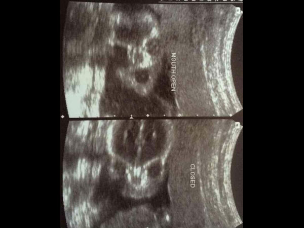 வேறு என்ன அறியலாம்?