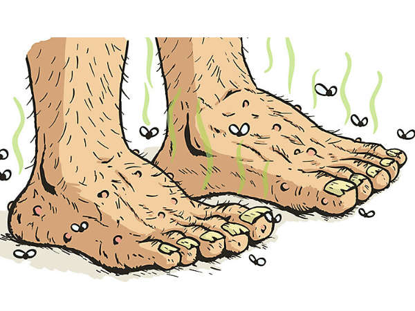 அழுக்கான பாதங்கள் அழுக்கான பாதங்கள்