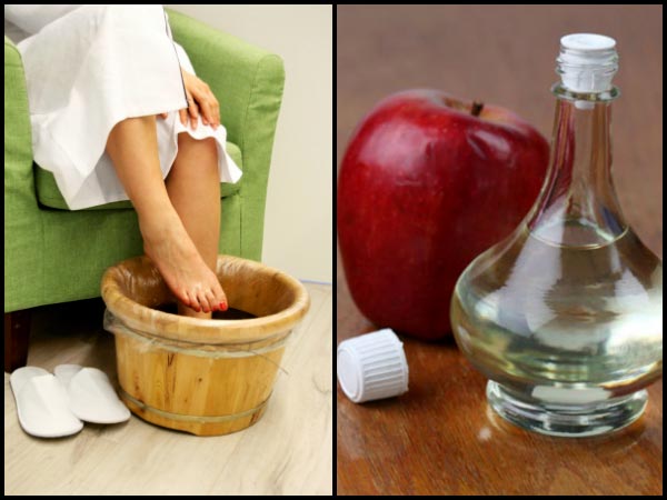 ஆப்பிள் சிடர் வினிகர் 