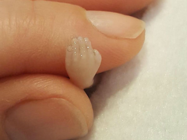 மனமுடைந்து போனார்!