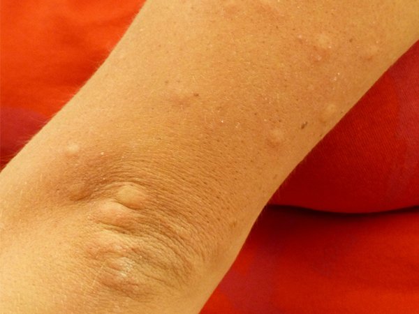 பரவும் விதம் 