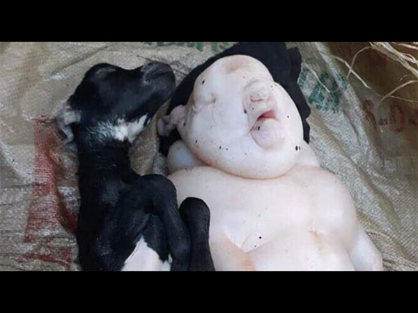 சிசேரியன்!